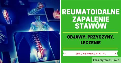 Reumatoidalne Zapalenie Staw W Rzs Objawy Przyczyny Leczenie