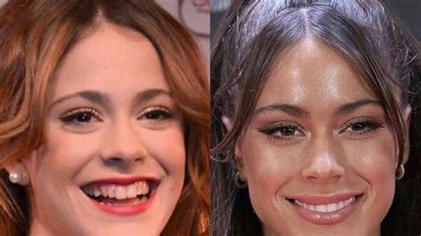 El Increíble Antes Y Después De Tini Stoessel El Retoque Estético Que