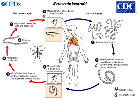 Mengenal Filariasis Atau Kaki Gajah Belajar Epidemiologi