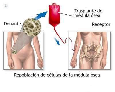 Trasplante De M Dula Hemat Logo Murcia Top Doctors