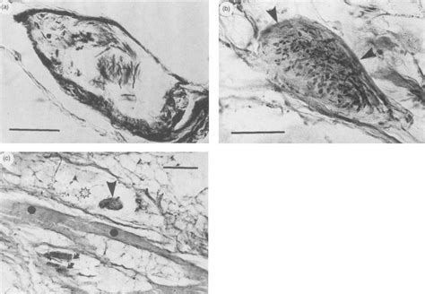 Golgi tendon organs. (A) An oval-shaped Golgi tendon organ in a normal ...