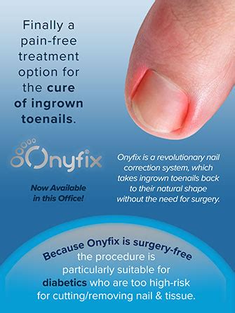 Onyfix For Ingrown Toenails Treatment Podiatrist Foot Doctor