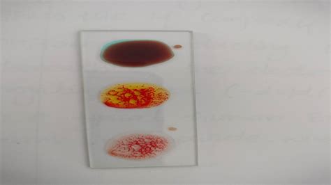 Understanding Blood Typing: The B+ Blood Group