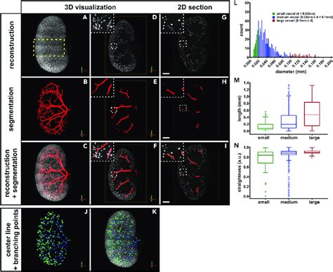 Hierarchical Random Walker Segmentation Of The Renal Blood Vasculature