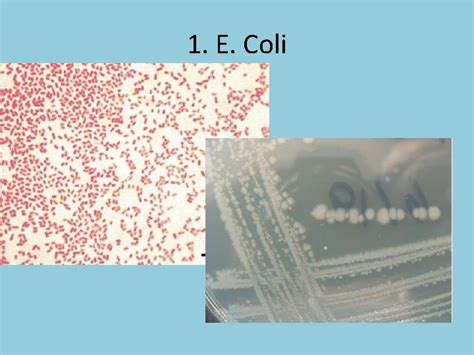 Bacterial Identification 1 E Coli Gram negative rods