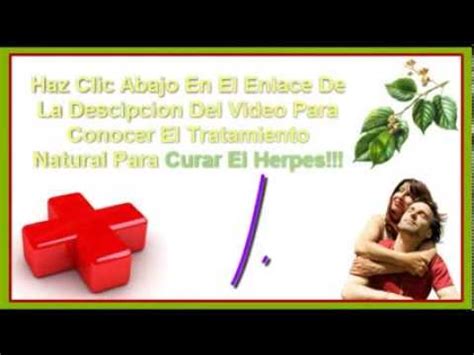 Como Eliminar El Herpes Labial De Manera Permanente Youtube