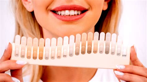 Sbiancamento Dentale Cosa Fare E Cosa Evitare Per Avere Denti Bianchi