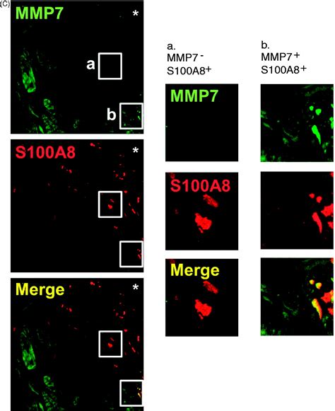 Cxcl Induced Plaque Macrophages Can Be Specifically Identified By Co