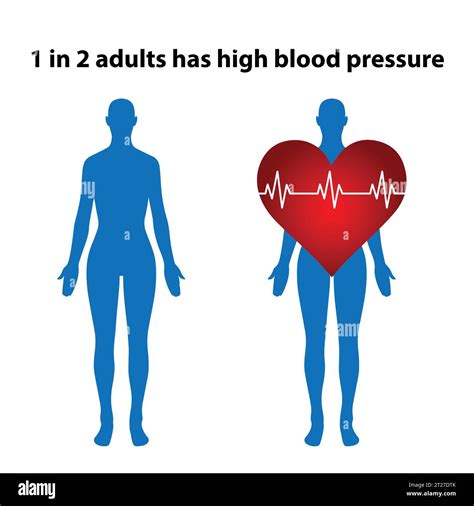 Vectores Vector De Hipertension Fotografías E Imágenes De Alta Resolución Alamy