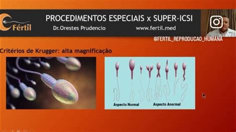 Procedimentos Especiais Em Fertilização In Vitro Super Icsi Youtube