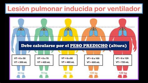 SDRA Síndrome de Dificultad Respiratoria Aguda Parte 2 Tratamiento