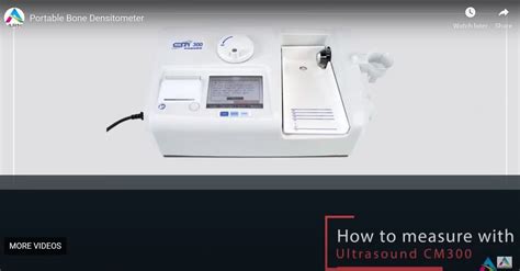 Portable Bone Densitometer For Hospital At Rs 798000 In Udaipur Id