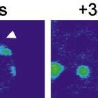 Frap Of Hp Gfp Reveals A Dynamic Association With Heterochromatin A