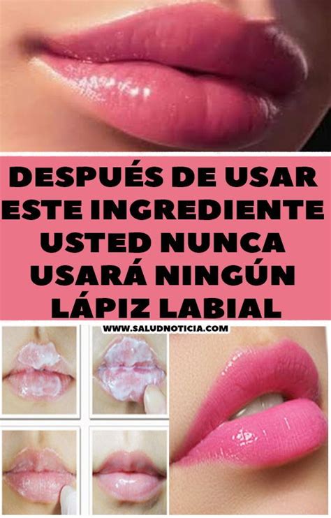 Granos De Fordyce En Los Labios Remedios Caseros Ideas Labios