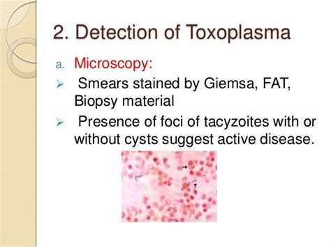 Laboratory Diagnosis Of Toxoplasmosis