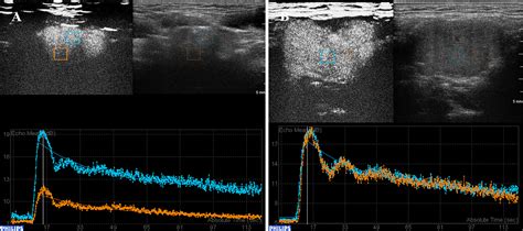 Frontiers Comparison Of Contrast Enhanced Ultrasonography To Color