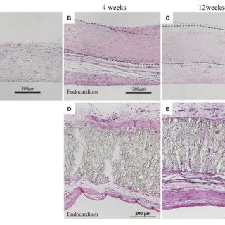 Results Of Histological Examination H E Staining A Image Before