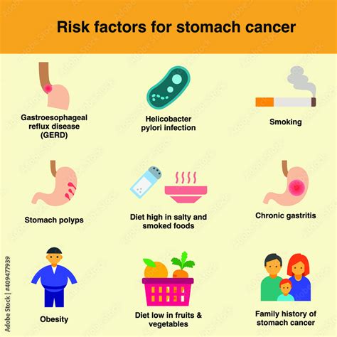 Vecteur Stock Risk Factor For Stomach Cancer Are Gerd Hpyloric Infection Smoking Polyps