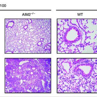 Absent In Melanoma 2 AIM2 Deficiency Affects Mouse Survival And