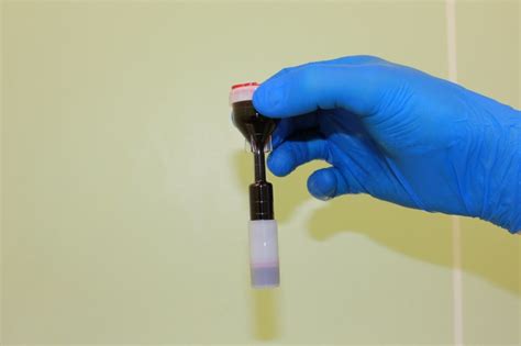 Методика получения PRP