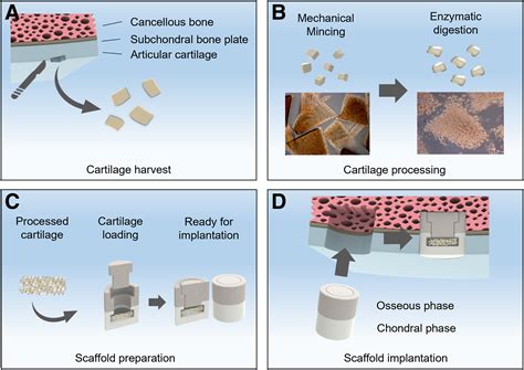 Biphasic Scaffold Loaded With Autologous Cartilage Yields Better Clinical Outcome And Magnetic