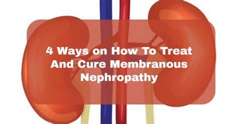 How To Treat And Cure Membranous Nephropathy Enoughinfo Daily Information And Reference Blog