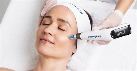 Motive S Ncepi Tratamentul Cu Dermapen Dermabeauty Clinique