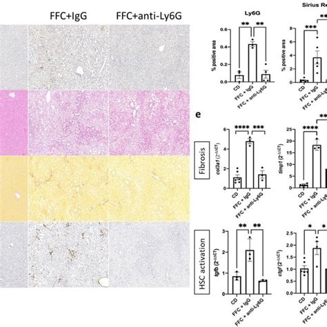 Hepatic Steatosis Fibrosis And Hepatic Stellate Cell Hsc Activation Download Scientific