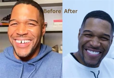 The Truth Behind Michael Strahan Teeth: Why the Iconic Gap Stays - Avangart Clinic