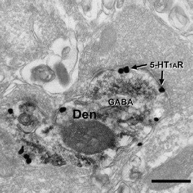 Dual Label Electron Microscopy Observation Showing Gaba Immunoreac