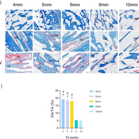 Masson S Trichrome Staining Results A Histological Observation Of