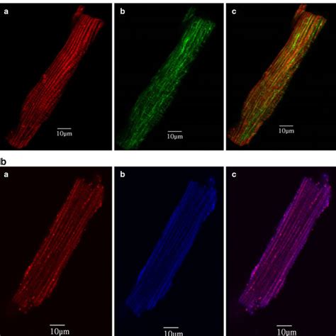 Representative Confocal Image Of Tubulin Ii Tubulin And