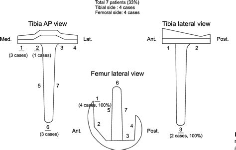 Table 1 From Revision Total Knee Arthroplasty Using NexGen R LCCK With