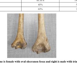 Figure From Sex Determination From Lower End Of Humerus Using