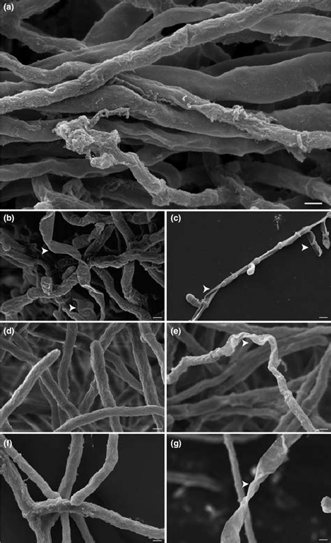 Scanning electron microscopy of hyphae of Microsporum canis exposed to ...