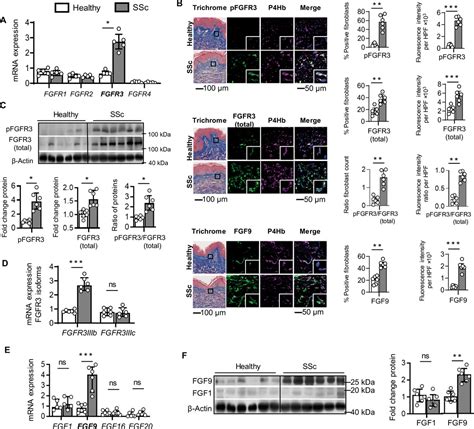 Fibroblast Growth Factor Receptor 3 Activates A Network Of Profibrotic