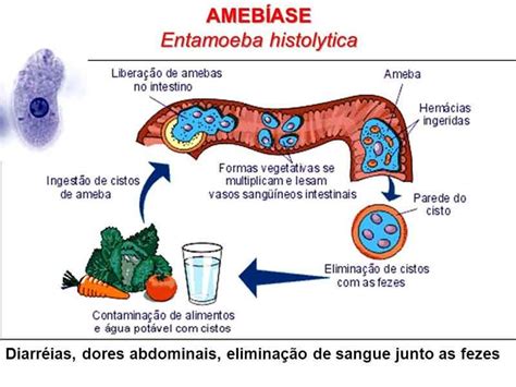 O Que É Bom Para Ameba - Ameba: o que são amebas, características, doenças e prevenção - Fotos