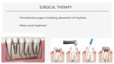 PERIO PPT TREATMENT PLAN.pptx