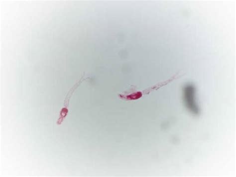 Schistosoma Mansoni Cercariae