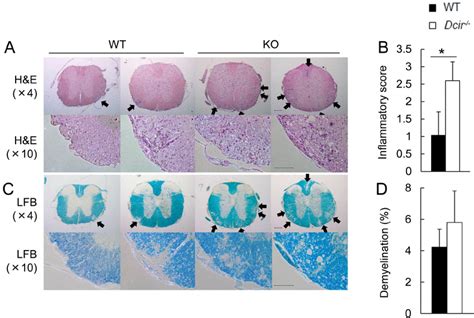 Histopathological Examination Of The Eae Developed Spinal Cords A At