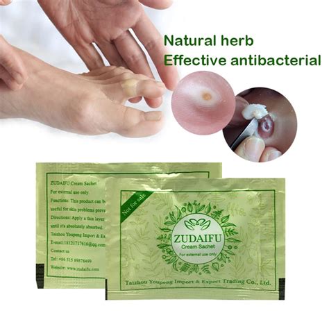 Aliexpress.com : Buy Body Herbal Material Psoriasis Creams and Eczema Psoriasis Ointment Skin ...