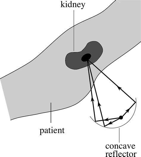 Pplato Flap Phys Sound A Wave Phenomenon