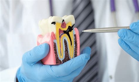 Vital Signs of Root Canal Infection: Recognizing Symptoms and Seeking Treatment