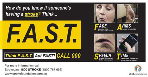 A mini stroke is a warning! A stroke may follow