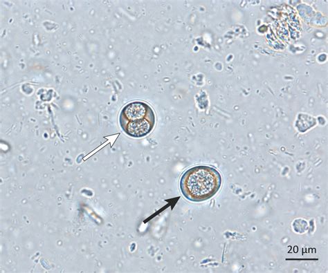 Clinical Image: Canine Stool Sample