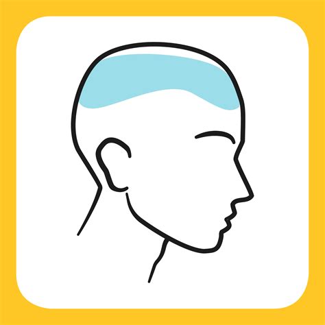 What Do Diffe Spots Of Headache Mean - Infoupdate.org