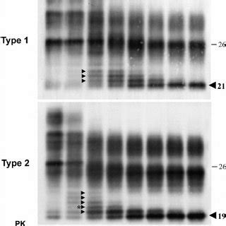 Diagram Of Human Prp Sc Showing The Primary Cleavage Sites For Both