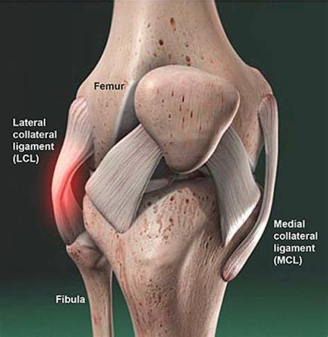 Lateral Collateral Ligament Injuries Idaho Sports Medicine Institute