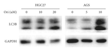 Oridonin Triggered Apoptosis By Inducing Autophagy In Gc Cells The