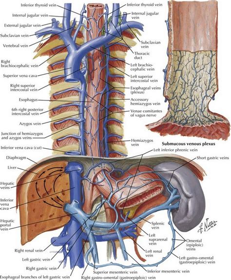 Nissen Fundoplication Basicmedical Key